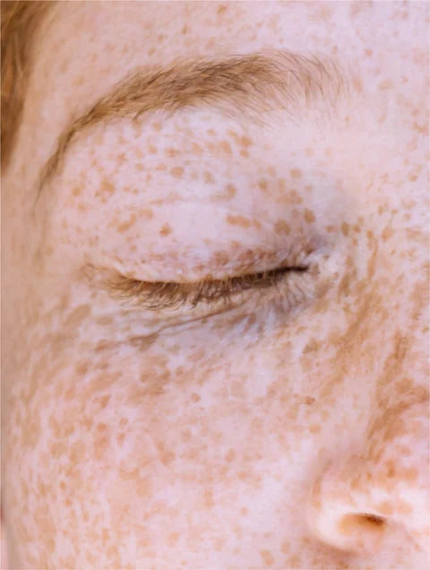 Vitamin C Glow Serum